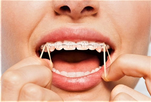 Oral Elastics