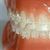 BioCrystal Brackets, 20/kit