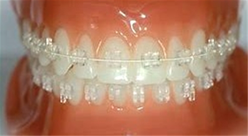 BioCrystal Brackets, 20/kit