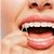 Oral Elastics