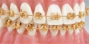  Plated Bracket Cases