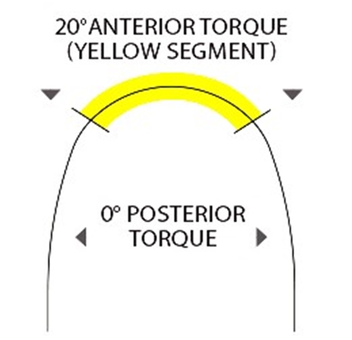 Tri-Sectional Beta-Torqued Arch Wires